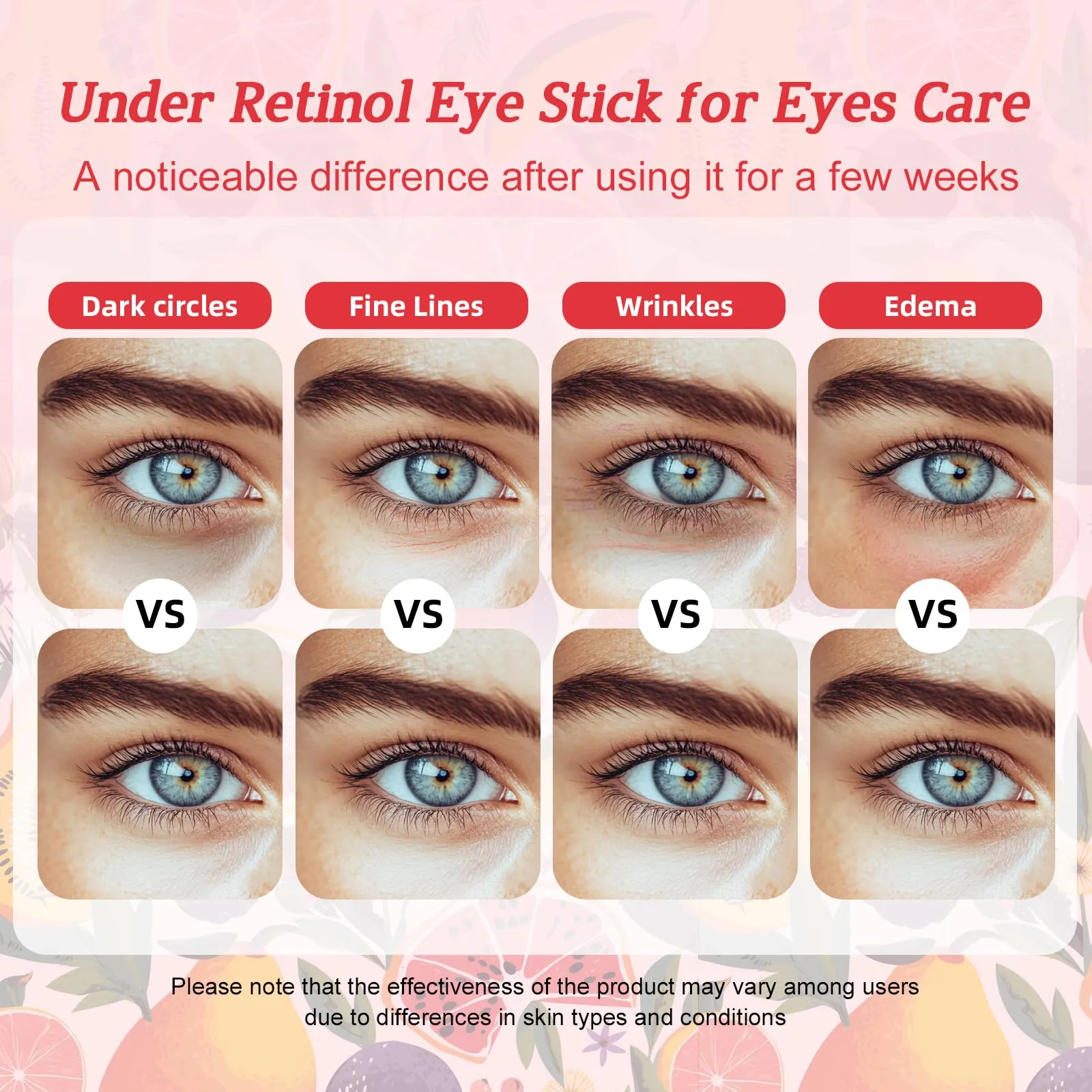 Radiia Retinol Eye Cream Stick for Dark Circles & Wrinkles - Hydrating Anti-Aging Eye Balm with Hyaluronic Acid, Mature Skin Treatment, 12 Scents, 60PCS